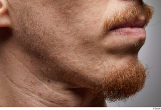  HD Face Skin John Hopkins chin face lips mouth skin pores skin texture wrinkles 0001.jpg